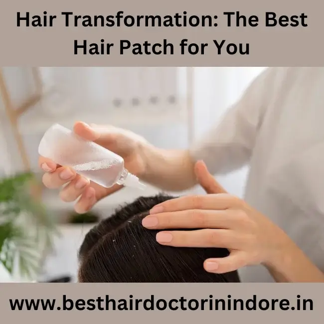 best hair patch in indore