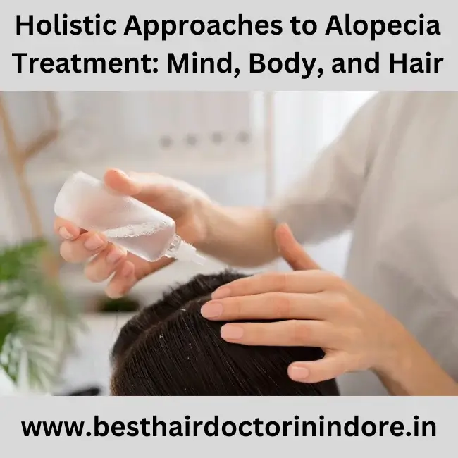 Best Alopecia Treatment in Indore