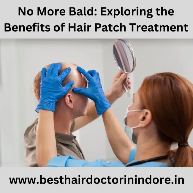 Best Hair patch in Indore