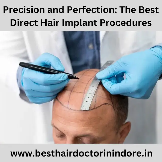 Precision and Perfection: The Best Direct Hair Implant Procedures