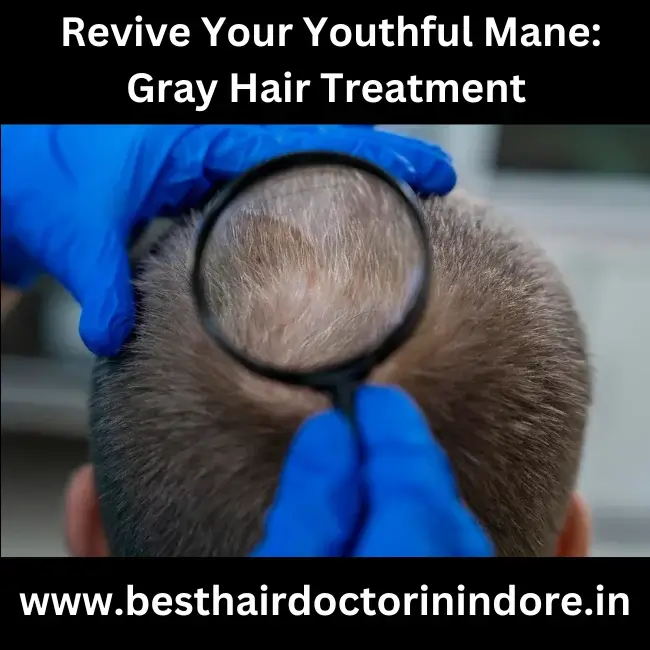 Gray Hair Treatment