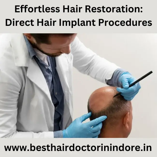 best direct hair implant