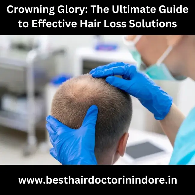 hair loss treatment