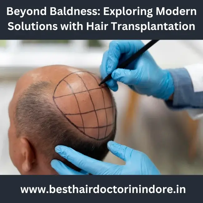 hair transplantation in Indore