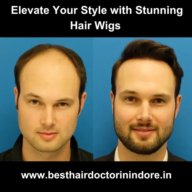 hair wig in Indore