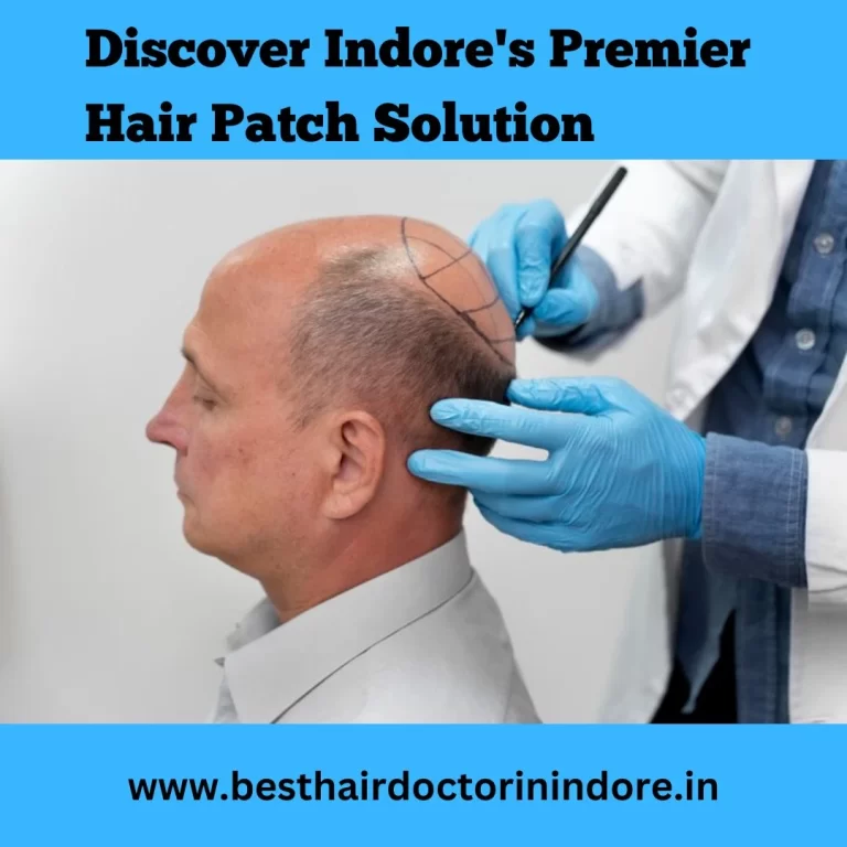 Best hair patch in Indore