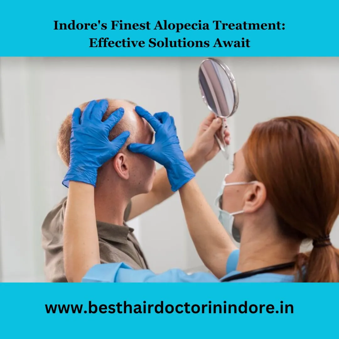 Best alopecia treatment in Indore