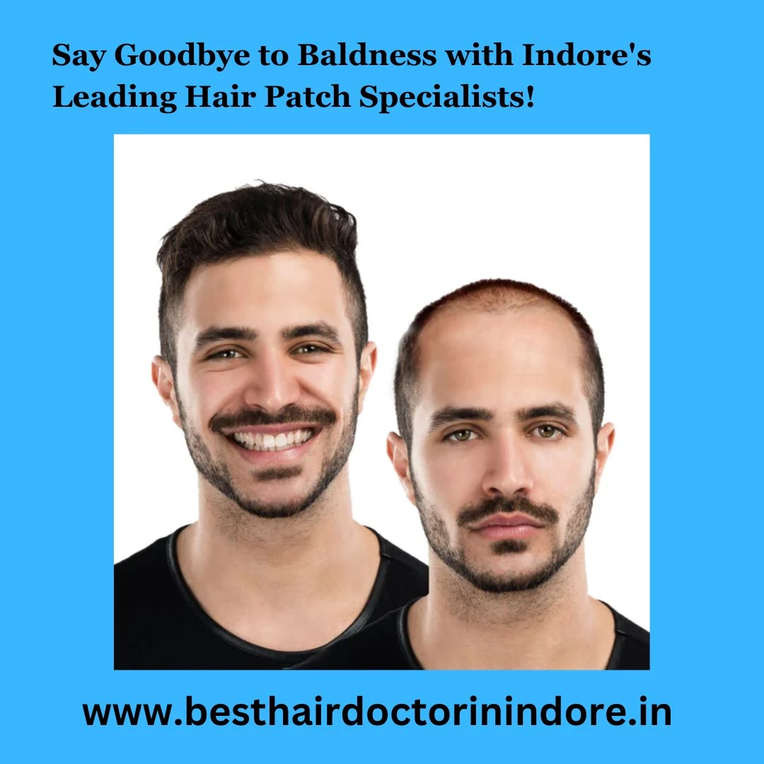 Hair patch in Indore