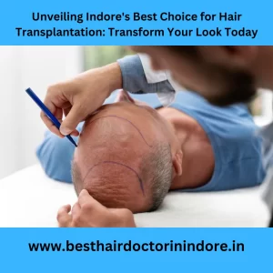 Hair Transplantation in Indore