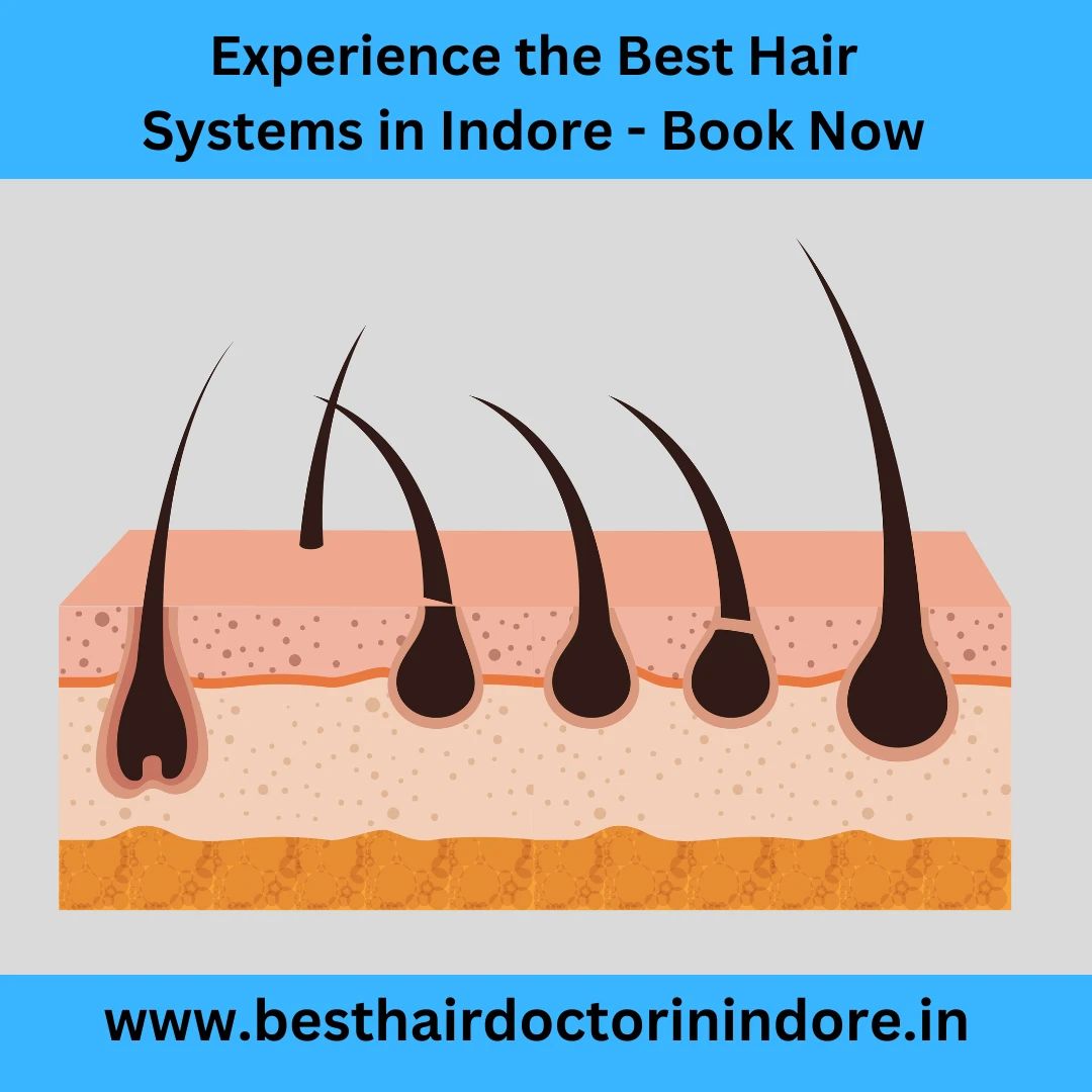 Hair system in Indore