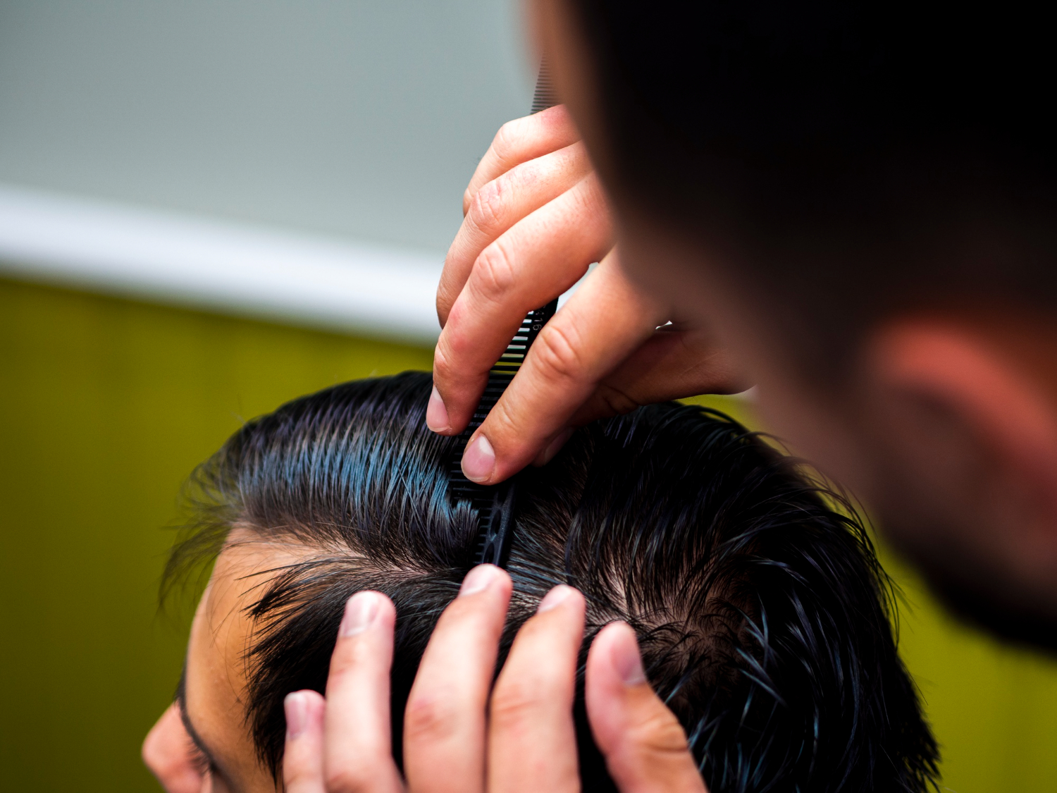 alopecia treatment in Indore