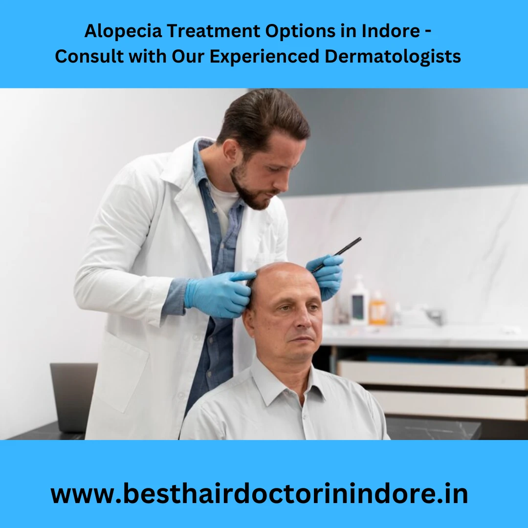 alopecia treatment in Indore