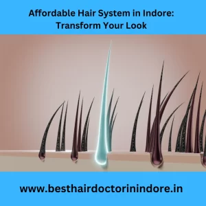 hair system in Indore