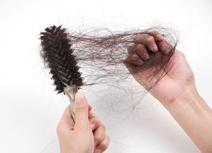 hair loss treatment in Indore