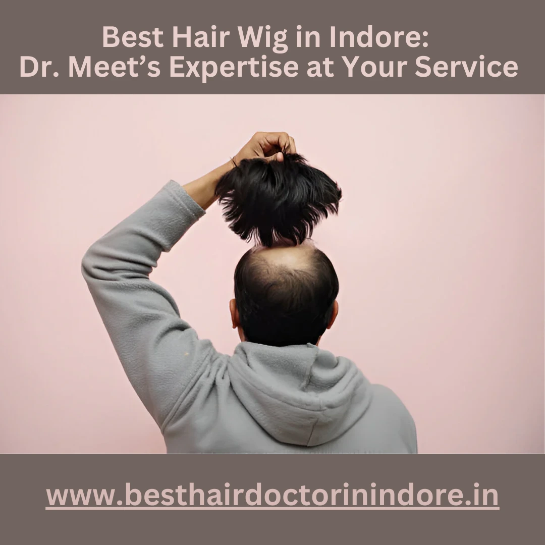 Best Hair wig in Indore