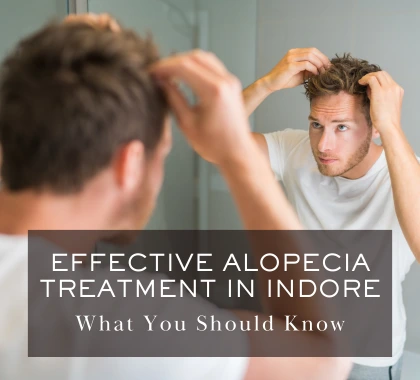 alopecia treatment in Indore