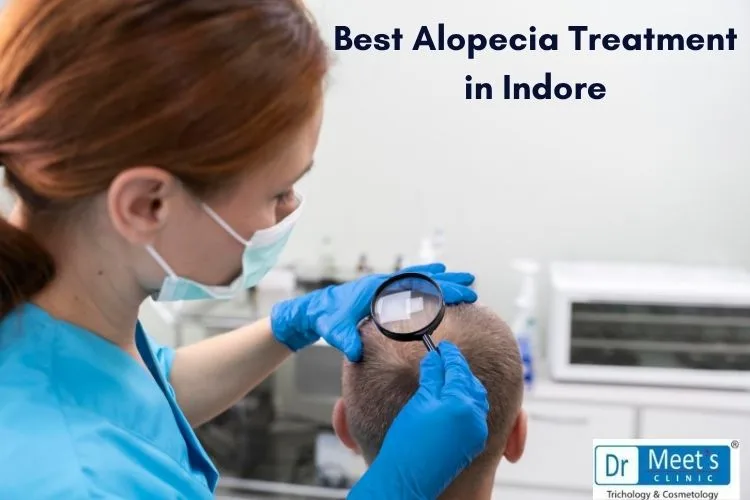 Best Alopecia Treatment in Indore