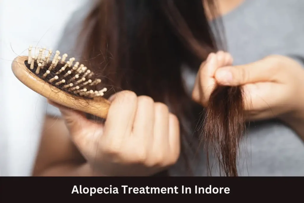 Alopecia treatment indore