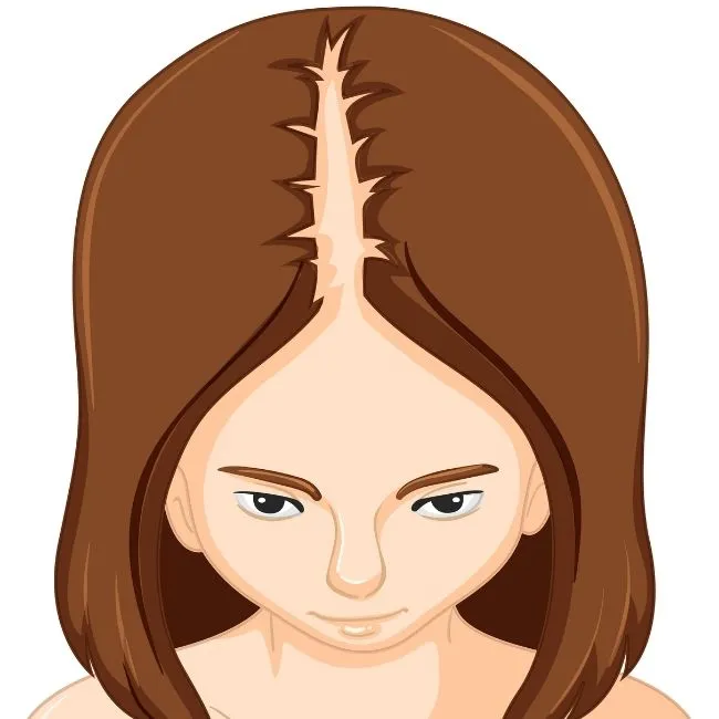 Hair Patch Treatment