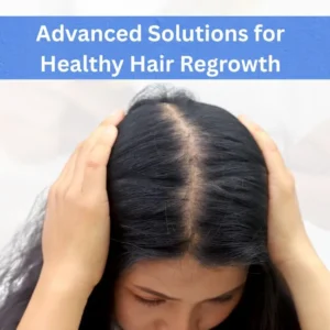 Best Hair loss treatment in Indore