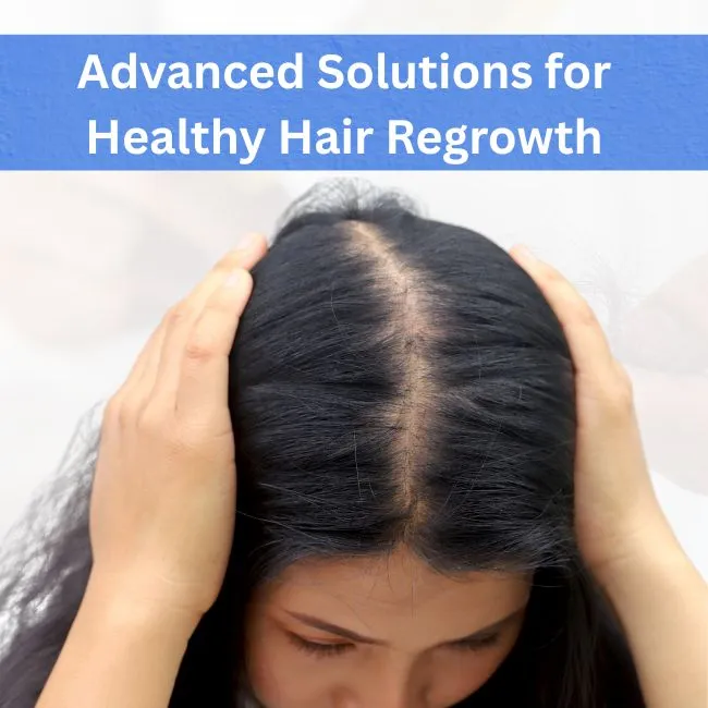 Best Hair loss treatment in Indore